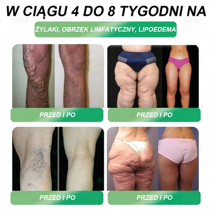 Polecane przez Mayo Clinic | Oficjalny sklep 👨‍⚕️𝑆𝑇𝐷𝐸𝐼® GLP-1 doustny roztwór na odchudzanie 💥 Otyłość, choroby układu krążenia, cukrzyca, bezdech senny, problemy ze stawami i inne
